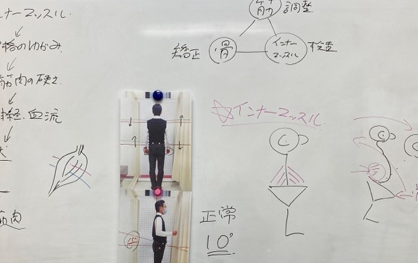 竹内建設のコラム 腰痛の原因は？